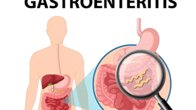 wellhealthorganic.com : key signs of gastroenteritis
