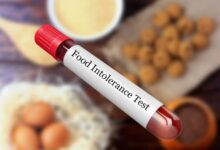 Food Intolerance Test