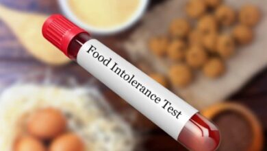 Food Intolerance Test