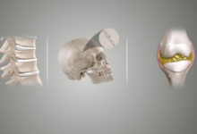 Concept Map: Classification of Joints