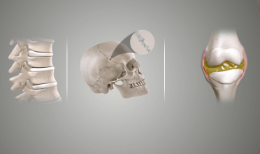 Concept Map: Classification of Joints